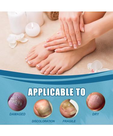 Nail Fungal Treatment Nails Essence Liquid Toenail Treatment Extra Strong Nail Repair Fingernail Toenail Care Fix Renew Damaged Broken Anti Fungus Nail Repair 30ML - Buy Online on GoSupps.com