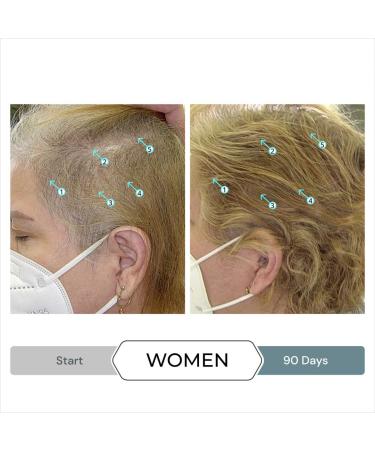 Revita.SOD Hair Growth Supplement by DS Laboratories - Fuller Thicker Stronger Hair, Combat Hair Loss & Thinning Due to Stress, Reduce Balding & Shedding - 30 Day Supply - Buy Online on GoSupps.com