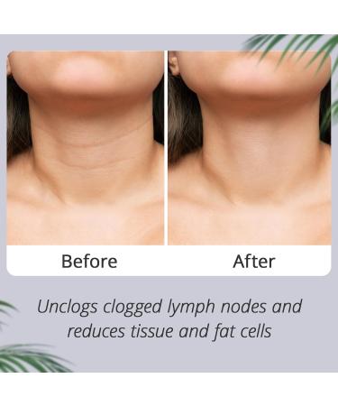 Leekalos Castor Oil Neck Pack Compress Orangic Castor for Neck Thyroid Pack Kit Light Purple - Buy Online on GoSupps.com