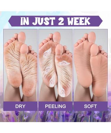 12 Pairs Foot Peel Mask - Baby Soft Skin Cracked Heels & Callus Care - Lavender & Aloe Vera - Exfoliating Foot Care for Men & Women - Buy Online on GoSupps.com