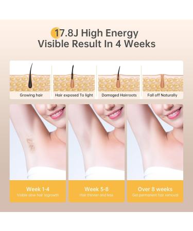 IPL Hair Removal Device Laser | 600NM 17.8J Efficient Systerm for Women and Men | 5 Energy Levels 2 Modes | Face/Back/Bikini | 999900 Flashes | B-White-Gold - Buy Online on GoSupps.com