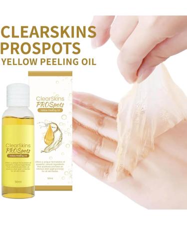 Body Peeling Oil Brightening Oil for Dark Skin Extra Strong Peeling Oil Peeling Oil for the Body Extra Strong Yellow Peeling Yellow Peeling Oil for Dark Skin (1PC) - Buy Online on GoSupps.com