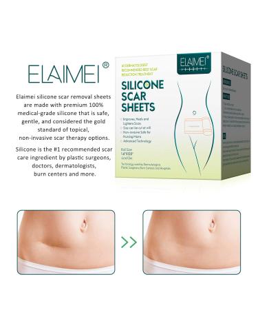 Silicone Gel Tape Roll for Scar Removal, Waterproof - 1.6 x 120 - Medical Grade Soft Silicone - Buy Online on GoSupps.com