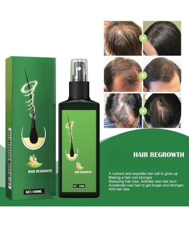 Beslibate 2 x Organic Growth Sprays More Nutritious Ginger Sprays for Women Men Hair Loss Treatment 100ml growhairthliquid-2 - Buy Online on GoSupps.com