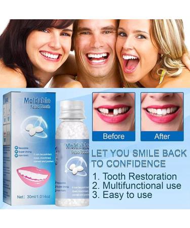 Tooth Repair Granules - Temporary Tooth Filling Kit | Fix Missing & Broken Teeth | Restores Confident Smile (10ml) - Buy Online on GoSupps.com