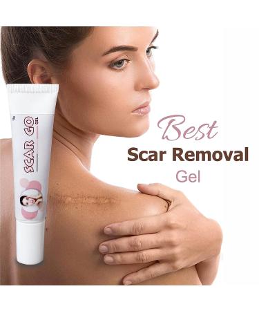 SS Anti-Scar Gel for Skin Lightening - 15 GM | For Old & New Scars, Keloids, Acne, Surgery Marks & Burns | Suitable for All Skin Types - Men & Women - Buy Online on GoSupps.com