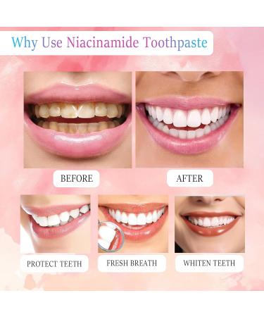 Niacinamide Whitening Toothpaste Triple White Probiotic Whitening Toothpaste Fluoride-Free| Sensitivity Relief | Fresh Breath & Stain Removal Formula | Sakura Peach Fragrance (1) - Buy Online on GoSupps.com