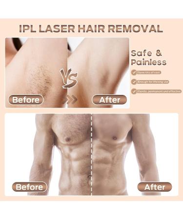 Laser Hair Removal IPL Device for Women & Men - Upgraded 999,900 Flashes, Permanent & Painless Hair Remover for Armpit, Lip, Bikini & Body - Buy Online on GoSupps.com