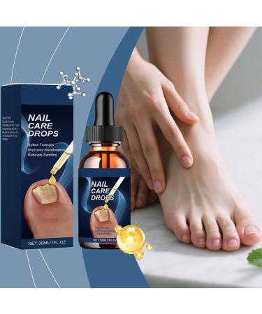 Ingrown Toenail Relief 15ml Gentle Nourishing Solution - Strengthening Nail Drops | For Dryness Redness Thickening Women Men Home Manicure Salon Pedicure Preparation - Buy Online on GoSupps.com
