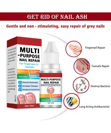 Fungal Nail Treatment for Toenail Extra Strong Multi-purpose Nail Repair Lotion for Fingernails Toenails Toe Nail Fungal Treatment Fixes Discolored Nails Safe Effective(10ML Red) - Buy Online on GoSupps.com