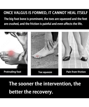 Orthopedic Toe Bunion Corrector Set Adjustable Day/Night Support for Pain Relief and Toe Alignment - Buy Online on GoSupps.com