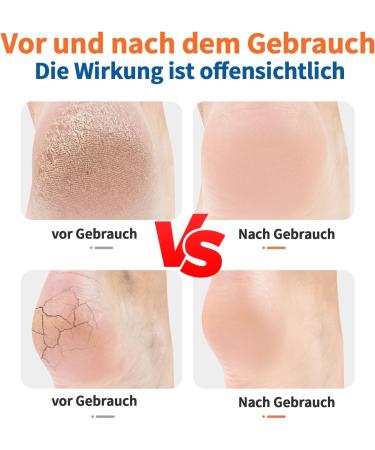 4 Pairs of Gel Heel Cushions for Plantar Fasciitis - Breathable Heel Pillows for Pain Relief & Cracked Heels - Buy Online on GoSupps.com