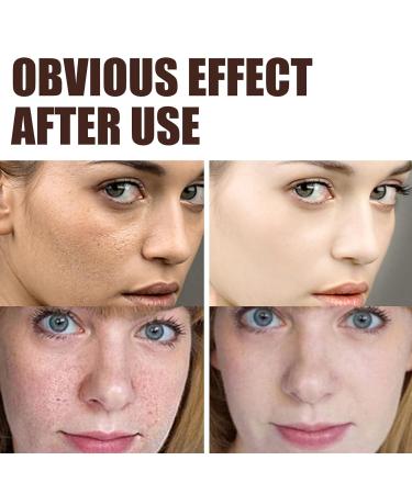 Retinol Cream for Face Skin Firming Anti-Aging Moisturizer with Vitamin C Hydrating Fine Line Treatment 1 oz& 2 oz (3) - Buy Online on GoSupps.com