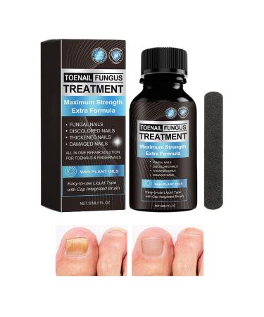Cracked Toenail Repair Nail Nourishing Solution 30ml Nourishing Fingernail Repair Solution for Bathing Daily Travel Pedicure Manicure Overnight at Home