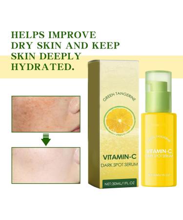 Green Orange Dark Spot Correcting Glow Serum - Women's Vitamin C Serum - Fade Acne Marks - Lasting Moisturizing - Anti-aging Facial Serum 30ml - Buy Online on GoSupps.com