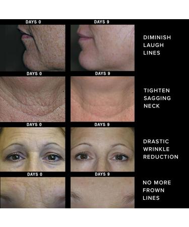 Stemulift Rapid Wrinkle Repair Serum - Anti-Aging Face Moisturizer for Fine Lines & Wrinkles - Shop Global Shipping - Buy Online on GoSupps.com