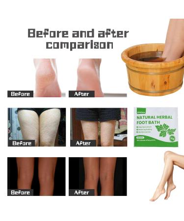Difethen Natural Mugwort/Wormwood Herbal Foot Soak Bags (10PCS) - Anti-Swelling Foot Spa for Metabolism & Lymphatic Ginger Bath - Foot Care Treatment | 15g/PCS - Buy Online on GoSupps.com