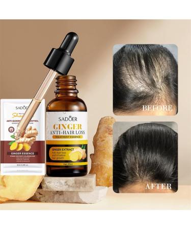 Sadoer Ginger Anti-Hair Loss Oil & Shampoo Set | Hair Growth Serum for Thicker Stronger Hair | Men's & Women's Treatment - Buy Online on GoSupps.com