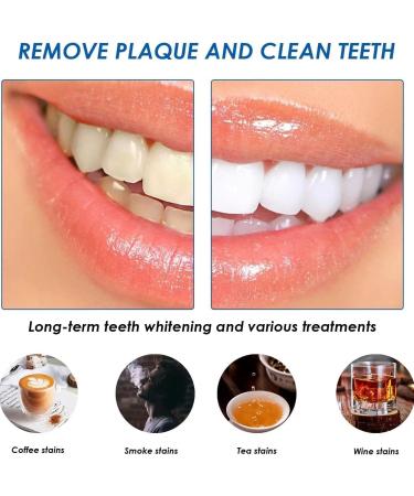 Elunara Bandes de blanchiment des dents blanches 5D bandes blanches de blanchiment des dents bandes blanches efficaces sensibilit r duite sans sensibilit id ales pour les voyages (2) - Buy Online on GoSupps.com