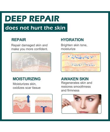 MIELIKKI Silicone Scar Sheets - Reusable 1.6x120 Roll for Scar Removal from Acne, C-Sections, Burns, and Surgery - Post Surgery Supplies - Buy Online on GoSupps.com