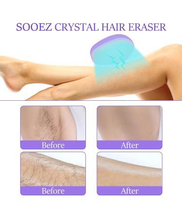 Crystal Hair Eraser for Hair Removal UQQU Crystal Hair Remover for Men and Women Magic Crystal Hair Remover with Gentle Skin Exfoliation Reusable Easy to Use Works On All Body Parts - Purple - Buy Online on GoSupps.com