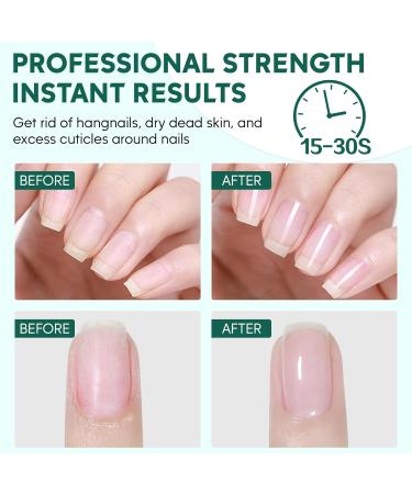 Cuticle Remover 8.45 FL OZ - Instant Softener & Salon Quality Care with Rosemary Scent - Professional Nail Care Gift for Women - Buy Online on GoSupps.com