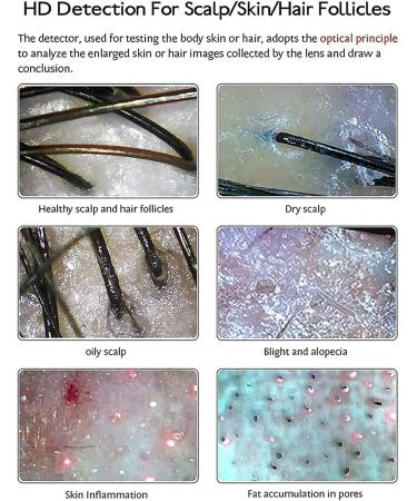 15Inch Skin Diagnosis Hair Analyzer Quad Spectrum Intelligent Dermal Detector Hair Follicle Analyzer for Beauty Salons - Buy Online on GoSupps.com