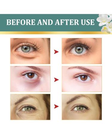 Jasmine Eye Cream for Dark Circles and Puffy Eyes - Anti Wrinkle Eye Cream for Women - Fade Fine Line Remove Eye Bags - Firming Lifting Moisturizing Improves Contours - Buy Online on GoSupps.com