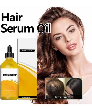 Neviux Natural Hair Growth Oil - Hair Growth Oil 2024 New Natural Hair Oil Rosemary Oil for Hair Growth Hair Growth Oil Prevent Hair Loss Improves Damaged Hair Hair Oil for Thin Hair Dry Damaged Hair - Buy Online on GoSupps.com