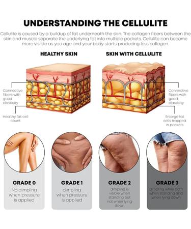 DUBUSH Bodyslim Firming Gel Body Shaping Cream Firming Body Cream Firming Tummy Anti Cellulite Firming Loose Skin - Buy Online on GoSupps.com