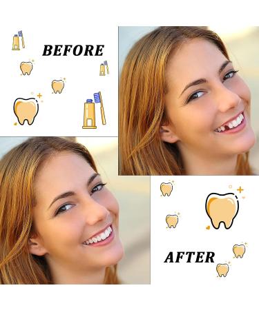 Resin Teeth Veneers for Halloween Cosplay Party Makeup - 200 Pieces - Buy Online on GoSupps.com