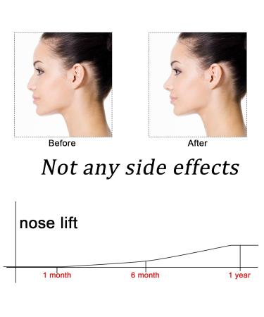 TrelaCo 11-Piece Nose Shaper Clip | Silicone Nose Lifter for Wide Low Inverted & Curved Noses | Instant Nose Lift & Shaping Solution - Buy Online on GoSupps.com