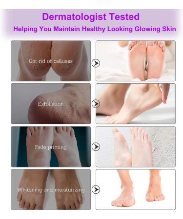 5 Pairs Foot Peel Mask lavender Foot Exfoliating Mask Socks Calluses Remover Dead Skin Moisturizing Feet Peeling Mask for Dry Skin Cracked Heels Foot SPA Socks for Women and Men (Lavender) - Buy Online on GoSupps.com