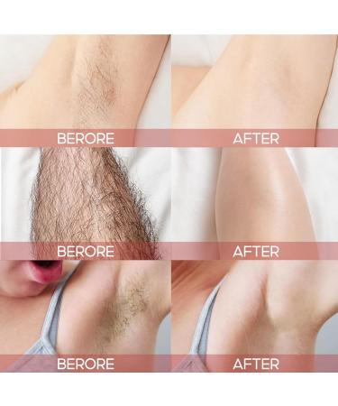 Hair Removal Cream for Women & Men - Painless Bikini Gel & Soothing Lotion for Unwanted Hair (3pcs) - International Shipping Available - Buy Online on GoSupps.com
