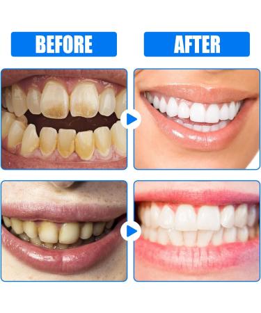 Natural Mango Flavor Toothpaste - Brightening Stain-Removing Long-Lasting Freshness | Eliminate Yellowing & Enhance Your Smile - Buy Online on GoSupps.com