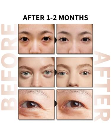 Buy Caffeine Eye Serum with EGCG - Reduce Dark Circles & Puffiness Anti-Aging Moisturizing 30ML - Global Shipping Available - Buy Online on GoSupps.com