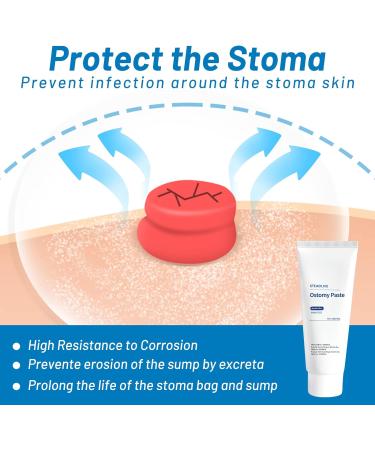Heagimed Alcohol-Free Stoma Skin Barrier Paste - 2.1oz Tube (2pcs) | Stomahesive Paste for Colostomy Bag Leakage Prevention - Buy Online on GoSupps.com