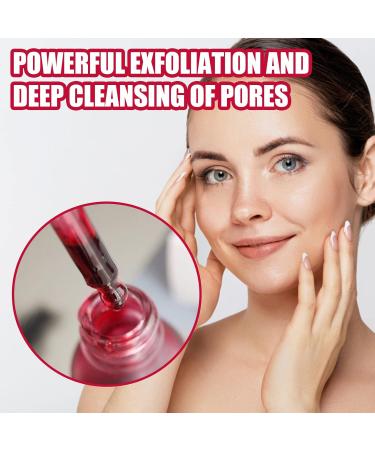 AHA 30% + BHA 2% Peeling Solution - Exfoliating Serum for Blemishes Pore Congestion & Fine Lines | 30ml International Shipping - Buy Online on GoSupps.com