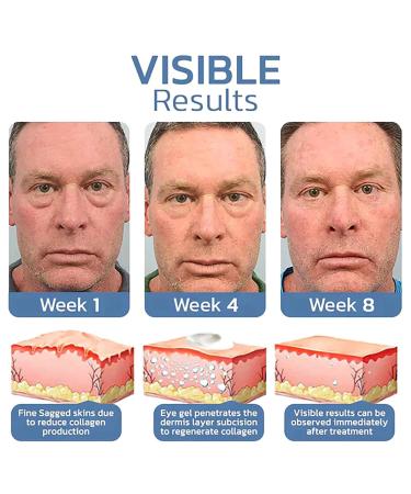 Lovilds Awaken Peptide Tight Eye Gel - Lifting Eye Treatment for Youthful Eyes (1PC) | Shop Internationally - Buy Online on GoSupps.com