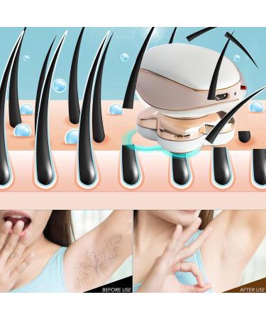 Buy Nicoone Electric Women s Razors - Cordless Pain-Free Bikini & Leg Hair Remover for Face & Body - Buy Online on GoSupps.com