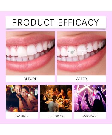 Fashion Tooth Gem Kit - DIY Tooth Beauty Decorations Multiple Styles Safe Materials For All(2PC) - Buy Online on GoSupps.com