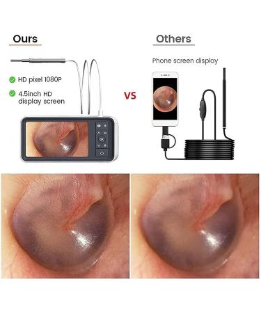 BAIXDM Digital Otoscope Camera - 4.5 HD Screen 3.9mm Ear Scope with Light Photo & Video Recording - Buy Online on GoSupps.com