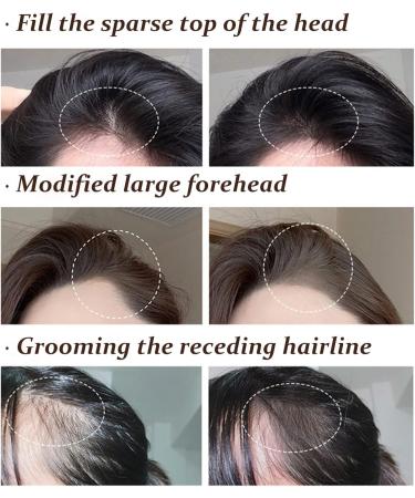 Hairline Powder - Root Touch Up Hair Powder - Gray Hair Coverage Hair - Waterproof Longlasting Thicken Fill Hair Volume - Sweatproof Natural Colour Looking Modification - Quick Cover Up (DARK BROWN) - Buy Online on GoSupps.com