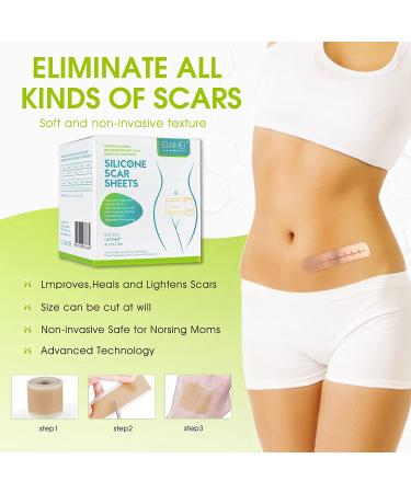 Silicone Scar Sheets 1.6 x 60 Roll - Effective Silicone Gel Tape for Scar Removal - C-Section, Keloid, Burn & Acne - 1.5M Roll - Buy Online on GoSupps.com