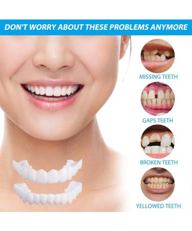 Frenzify Fake Teeth - Cosmetic Veneers & Whitening Dentures for Adults | Temporary Tooth Covers with Tweezers - International Shipping Available - Buy Online on GoSupps.com