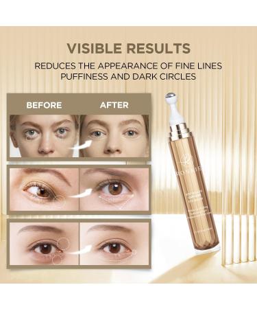 RONKIE Eye Cream for Dark Circles: Under Eye Cream with Caffeine Retinol - Reduces Under Eye Bags and Fine Lines Gold - Buy Online on GoSupps.com
