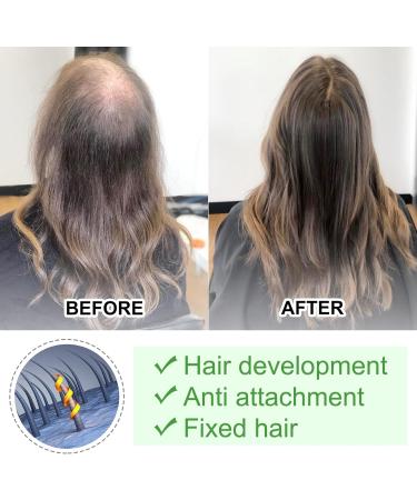 Pure Rosemary Oil for Hair Growth - Natural Scalp Nourishment & Hair Loss Reduction - Buy Online on GoSupps.com