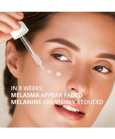 Abera Melasma Serum - Dark Spot Corrector & Melanin Treatment for All Skin Types | 2-Pack with HA & Niacinamide - Buy Online on GoSupps.com