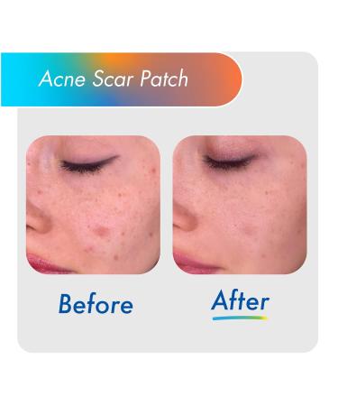 Fazit Acne Scar Treatment Patches - 24 Individual Patches for Face Bikini & Body - Effective Acne Scar Remover - Buy Online on GoSupps.com