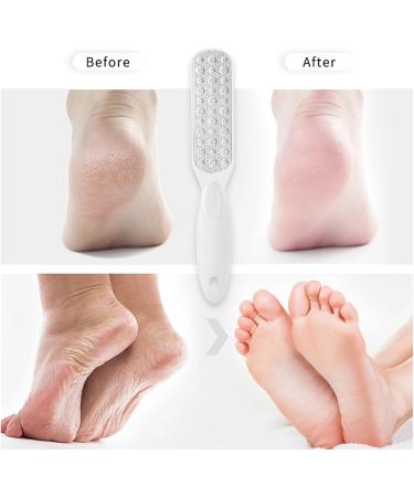 Foot File Foot Scraper for Hard Skin Professional Pedicure Double Side Foot Files Callus Remover Foot Scrubber Metal Foot Rasp Foot Care Tool for Dead Skin Cracked Heels Corn Removal - Buy Online on GoSupps.com